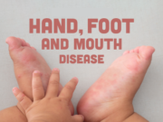 புதிய வகை தொற்று நோய் பற்றி பொது மக்களுக்கு விழிப்புணர்வு வழங்கியுள்ள சுகாதார அமைச்சகம்.