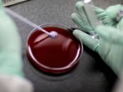 இரத்த சோகை மற்றும் தலசீமியாவுக்கான முதல் மரபணு சிகிச்சையை அங்கீகரித்துள்ள SFDA.