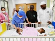 சவூதி மருத்துவக் குழு நைஜீரியாவில் ஒட்டிப்பிறந்த இரட்டைக் குழந்தைகளைப் பிரிக்கும் அறுவை சிகிச்சையைத் தொடங்கியது.